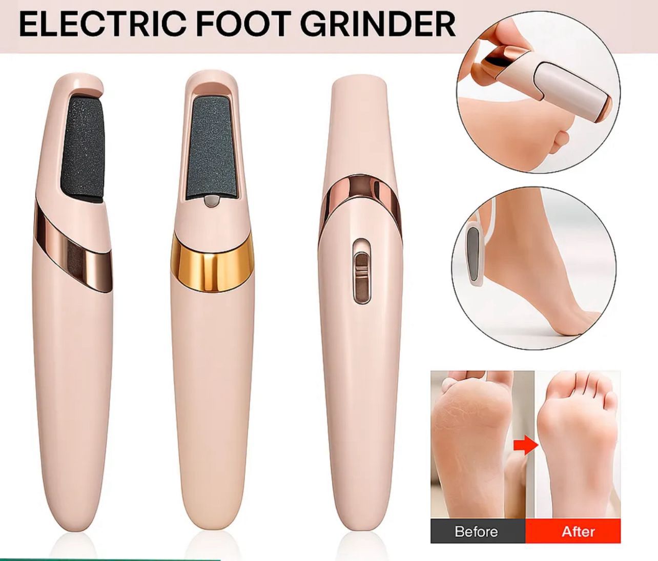 Electric Foot File Grinder – Salon Smooth Feet at Home!
