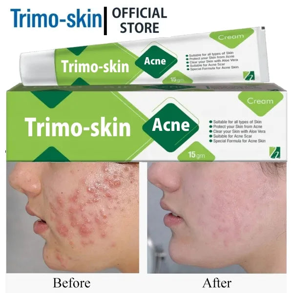Anti Acne Face Treatment for Dark Spots Acne Shrink & Acne Scar Remove Cream: Skin Care Product