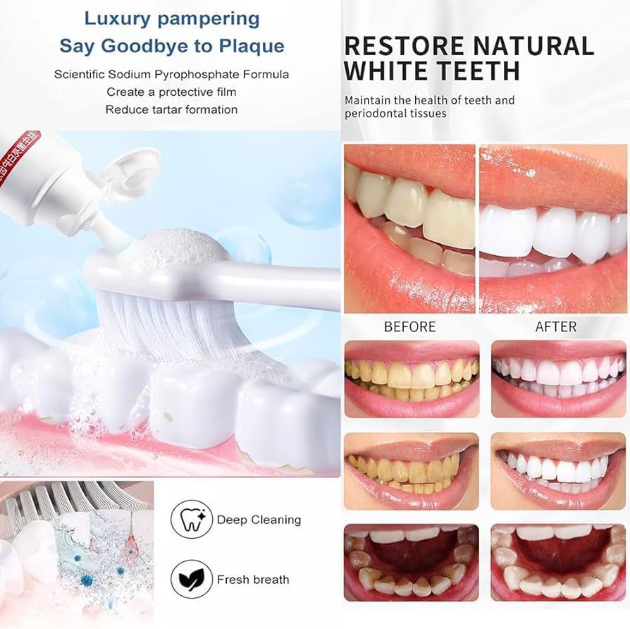 SP4 Ultra Whitening Toothpaste